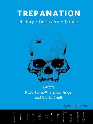 cover image of Trepanation
